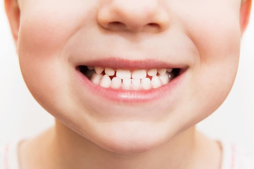Kodėl svarbūs kūdikio dantys?