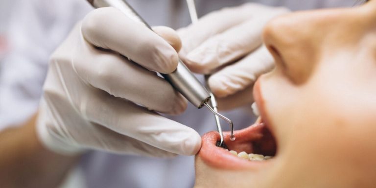 Odontologinės procedūros, padedančios palaikyti nepriekaištingą dantų būklę