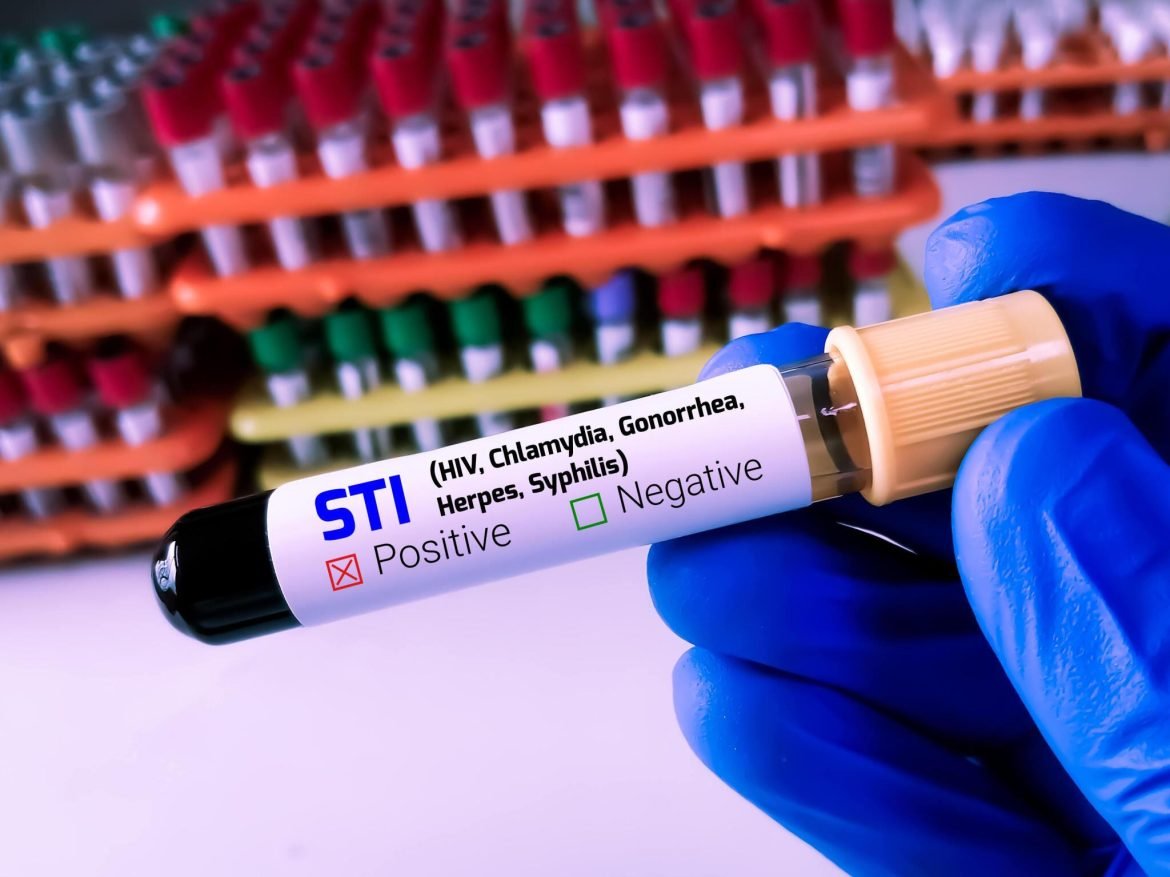Kaip sužinoti, ar kas nors serga STD?