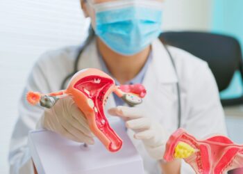 Gimdos kaklelio kanalo polipas