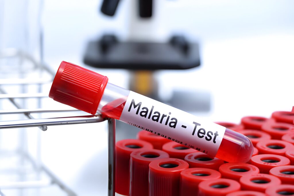 Eksperimentinė NIH maliarijos monokloninių antikūnų apsauga Malio vaikams