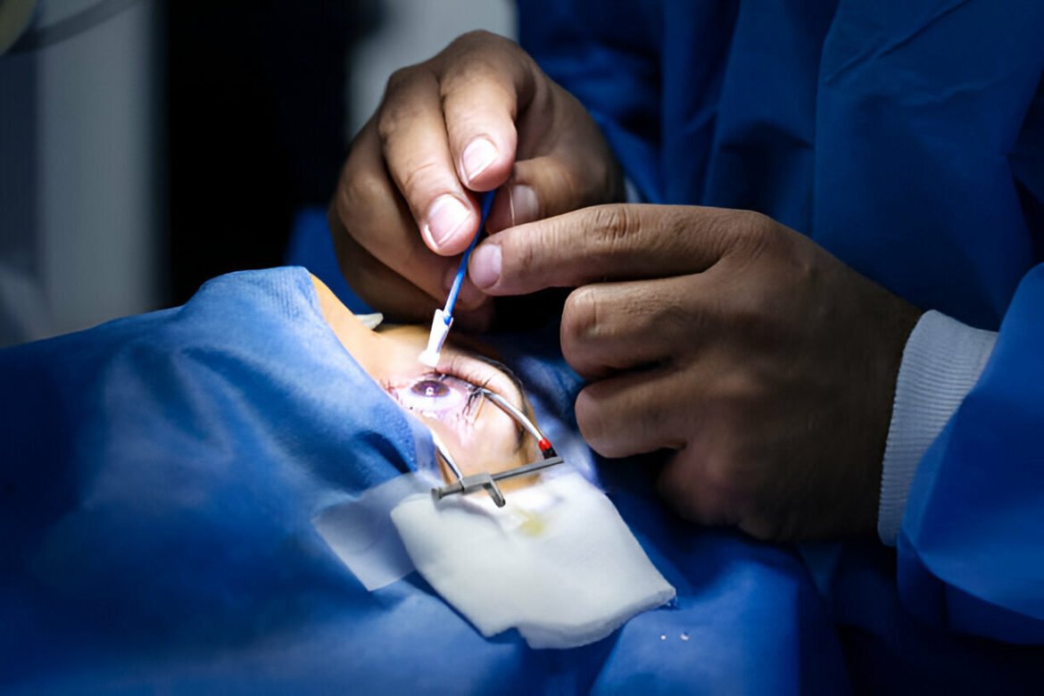 LASIK akių chirurgija: veiksniai, į kuriuos reikia atsižvelgti