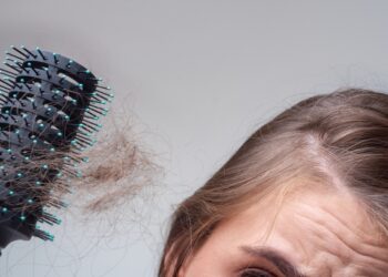 Plaukų slinkimas (alopecija)