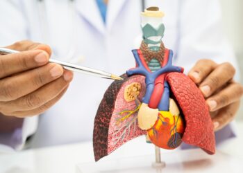 Plaučių uždegimas