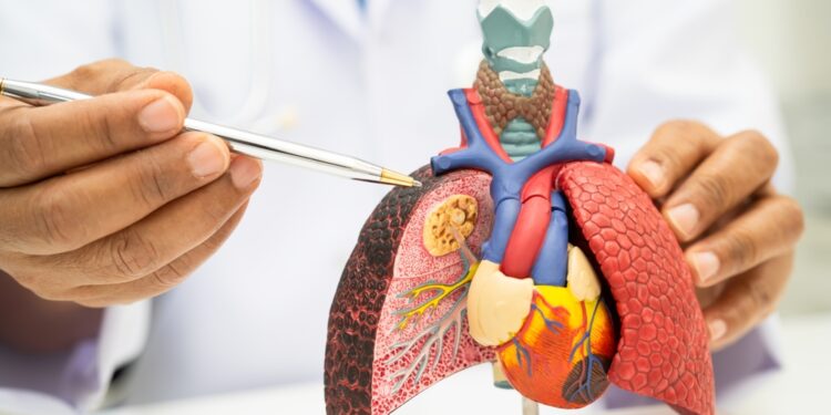 Plaučių uždegimas