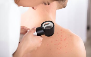 Dermatovenerologas