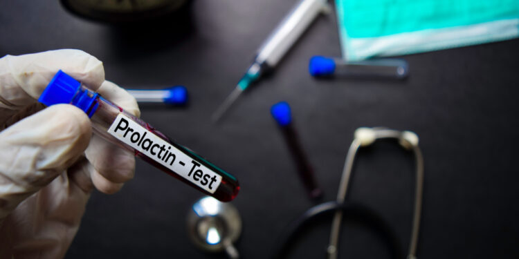 Prolaktinas