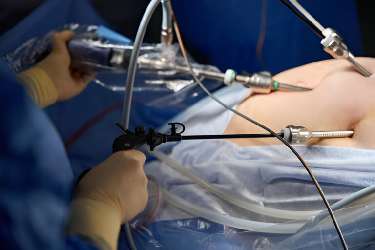 Laparoskopinė herniorafija: greitas ir saugus gydymas
