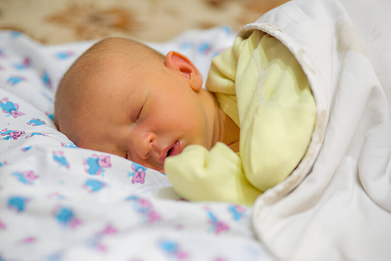 Neonatalinė gelta: simptomai, priežastys ir gydymas