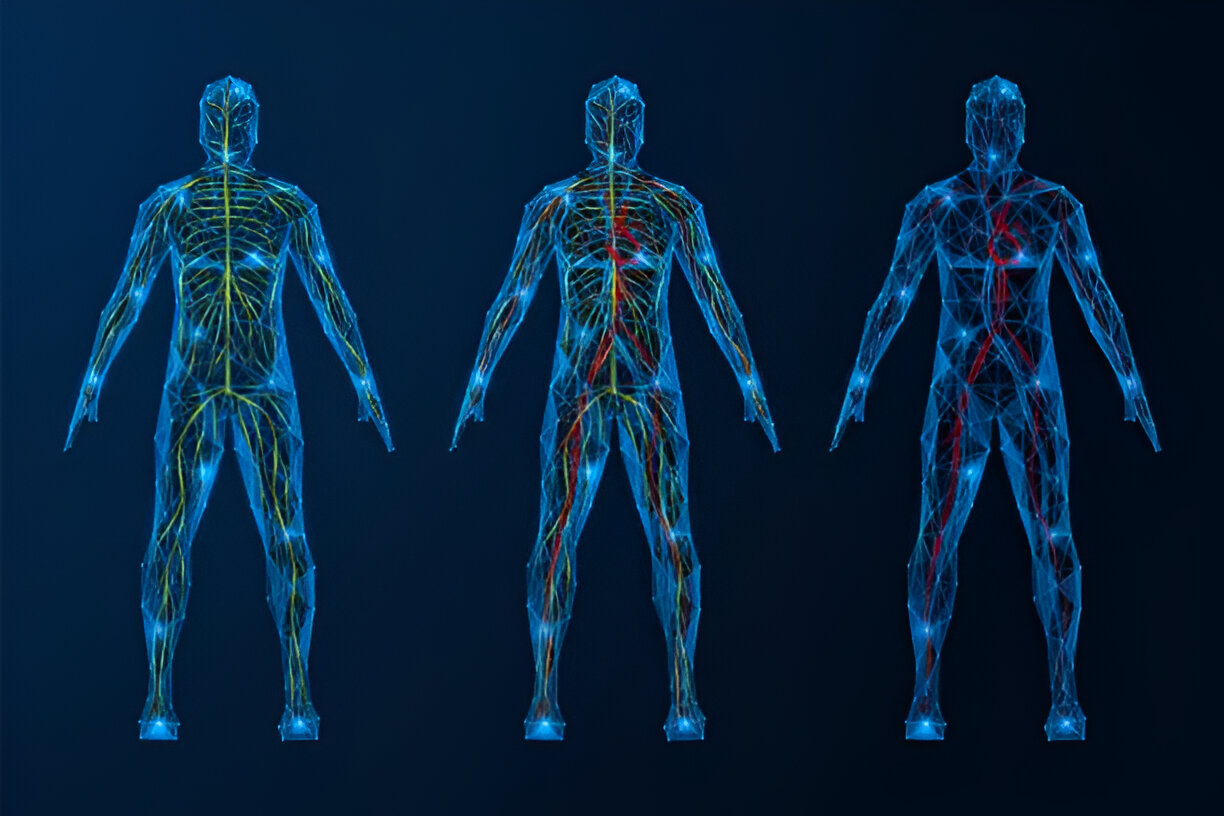 Vainikini Arterij Liga Rizika Diagnoz Ir Gydymas