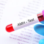AMH TYRIMAS