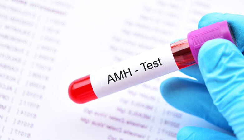 AMH TYRIMAS