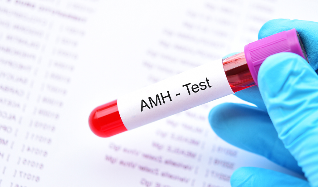 Antimuliarinio hormono (AMH) tyrimas