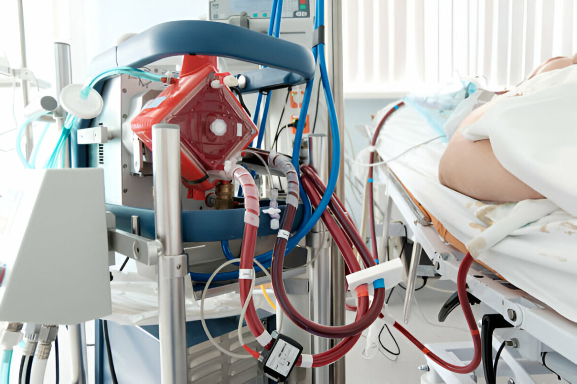Ekstrakorporinė membraninė oksigenacija: ką reikia žinoti?