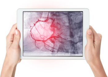 Ūminė arterijų okliuzija