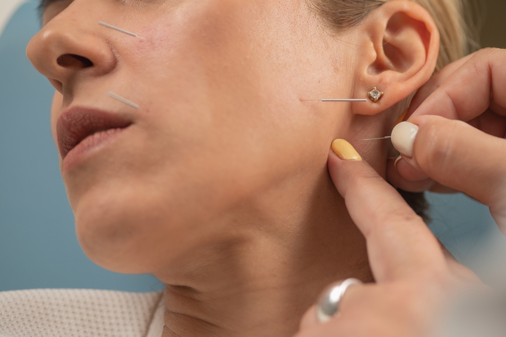 Belo paralyžius (Veidinio nervo neuropatija) : simptomai ir gydymas