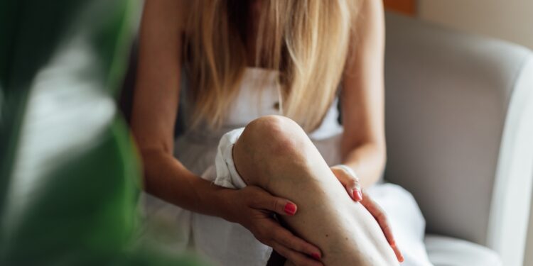 Akytkaulio ančiu trombozė: simptomai, priežastys ir gydymas