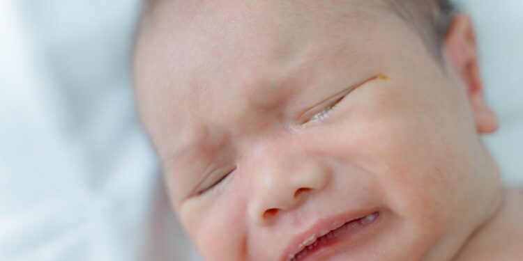 Ašarų maišelio uždegimas (dakriocistitas): simptomai, priežastys ir gydymas