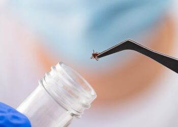 Autoimuninis encefalitas: kas tai, simptomai ir gydymas