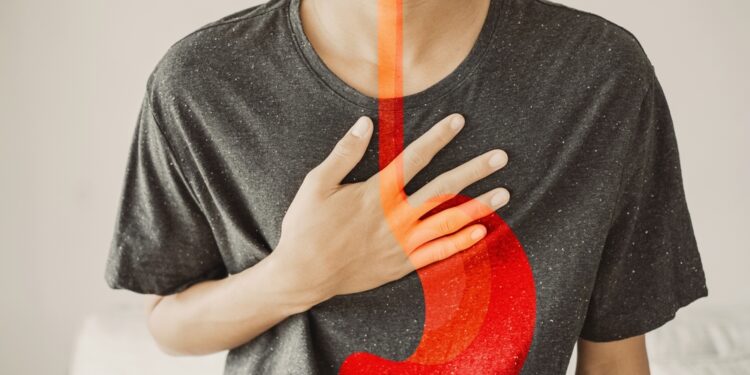 Bareto stemplė: simptomai, priežastys, gydymas ir vaistai