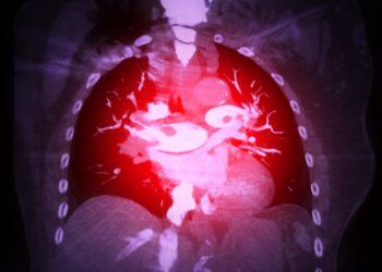 Pagrindinė arterija: vieta, sandara ir funkcija