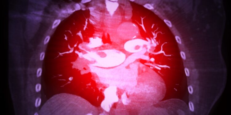 Pagrindinė arterija: vieta, sandara ir funkcija