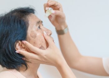 Benoksinato ir fluoresceino akių tirpalas