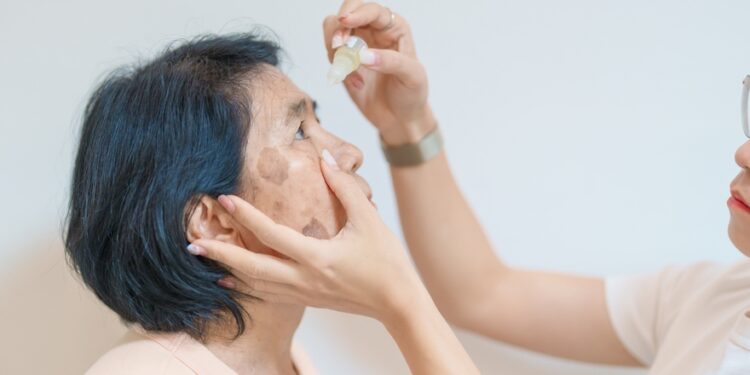 Benoksinato ir fluoresceino akių tirpalas