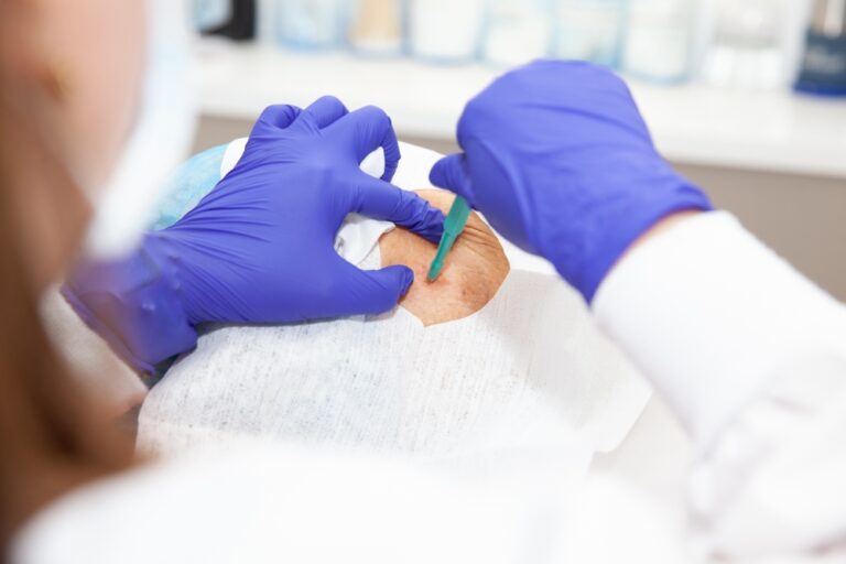 Kas yra biopsija? Paskirtis ir rezultatai