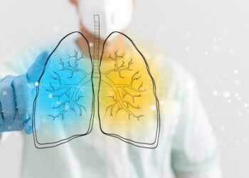 Bronchektazė: priežastys, simptomai, gydymas ir profilaktika