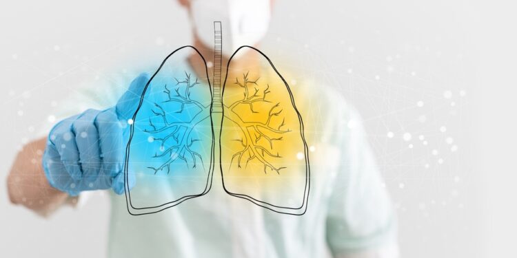 Bronchektazė: priežastys, simptomai, gydymas ir profilaktika