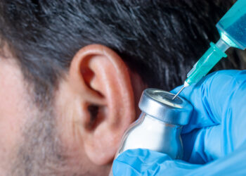 Cholesteatoma: simptomai, priežastys ir gydymas