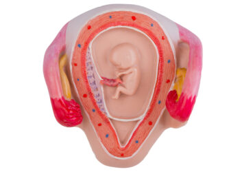 Chorioamnionitas: priežastys, simptomai, diagnostika ir gydymas