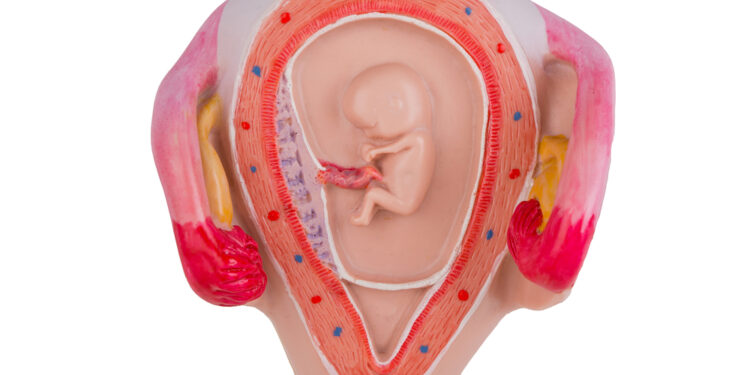 Chorioamnionitas: priežastys, simptomai, diagnostika ir gydymas