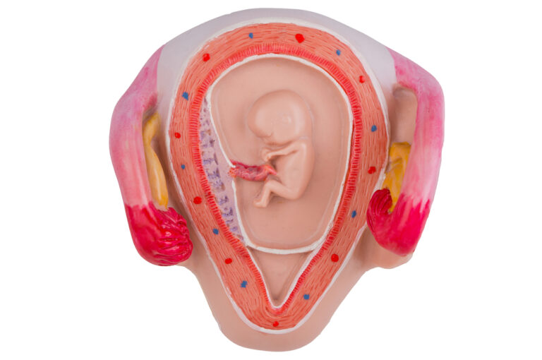 Chorioamnionitas: priežastys, simptomai, diagnostika ir gydymas