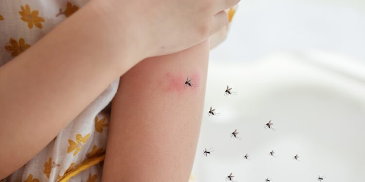 Čikungunija: Priežastys, simptomai, diagnostika ir gydymas