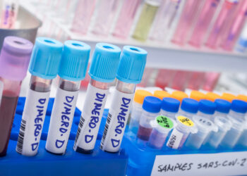 Citokinų išsiskyrimo sindromas: simptomai, esmė ir gydymas