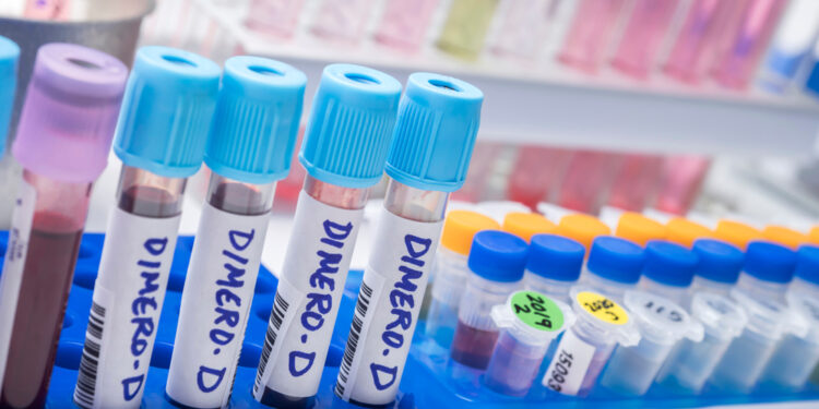 Citokinų išsiskyrimo sindromas: simptomai, esmė ir gydymas