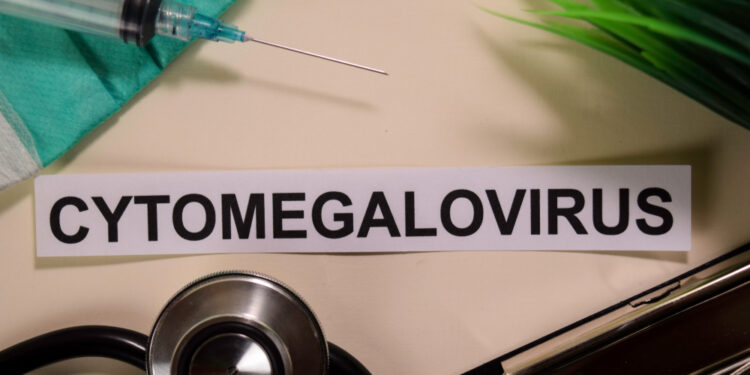 Citomegalo viruso (CMV) infekcija: priežastys ir simptomai