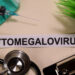 Citomegalo viruso (CMV) infekcija: priežastys ir simptomai