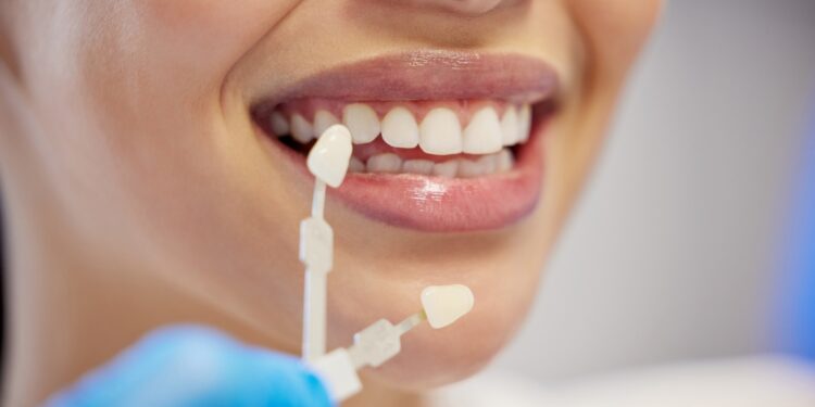 Danties dangalo cista: simptomai, priežastys ir gydymas