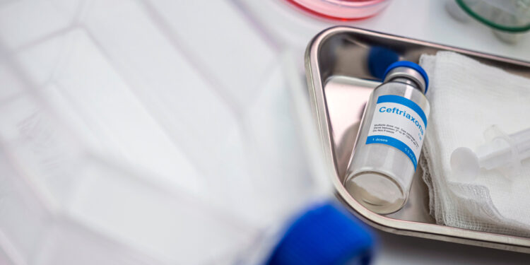 Demiielinizuojančios ligos: kas tai, simptomai ir gydymas