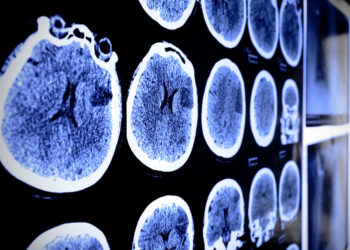 Desmoplastinių smulkių apvalių ląstelių navikai