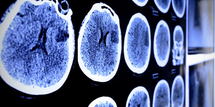 Desmoplastinių smulkių apvalių ląstelių navikai