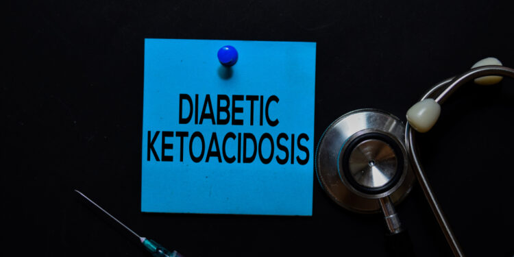 Diabetinė ketoacidozė (DKA): simptomai ir gydymas