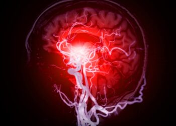 Galvos smegenų kraujagyslių ligos: tipai, priežastys ir simptomai