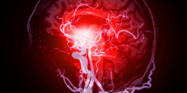 Galimi korektiški lietuviški pavadinimai:**1.** Galvos smegenų kraujagyslių ligos: tipai, priežastys ir simptomai  **2.** Smegenų kraujotakos ligos: rūšys, priežastys ir simptomaiPapildoma pastaba:  „Cerebrovascular disease“ dažniausiai verčiama „galvos smegenų kraujagyslių ligos“ arba trumpiau – „smegenų kraujotakos ligos“ priklausomai nuo konteksto. Pirmasis variantas yra tiksliausias ir dažniausiai vartojamas medicininiuose tekstuose.**Rekomenduotinas variantas:**  Galvos smegenų kraujagyslių ligos: tipai, priežastys ir simptomai