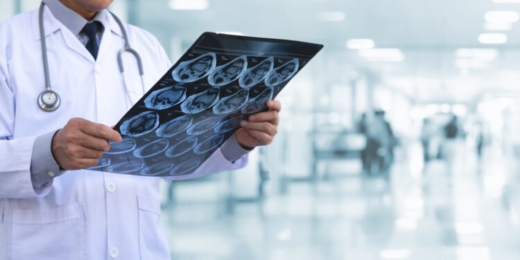 Gerybiniai navikai: apibrėžimas, rūšys ir simptomai