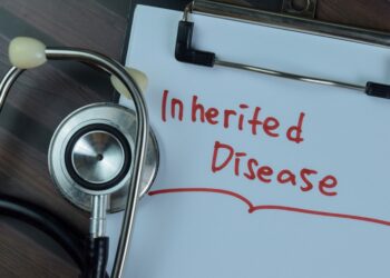 Chorėja: priežastys, simptomai, diagnostika ir gydymas