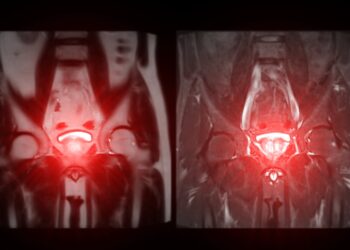 Įgimtos šlapimo sistemos anomalijos: rūšys ir diagnostika